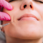 Dermal Filler
