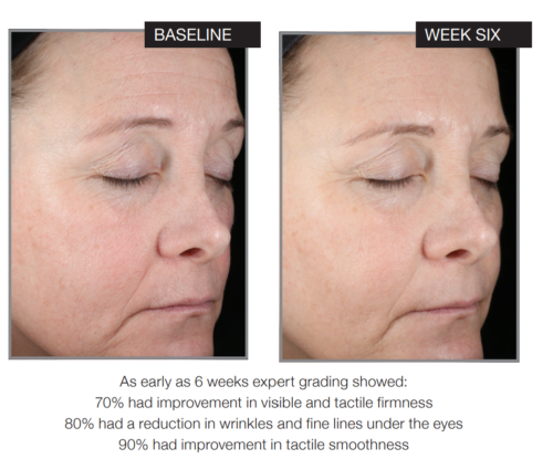 Plumping Hyaluronic Acid Serum - Image 2