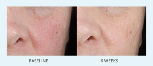 Plumping Hyaluronic Acid Serum - Image 3